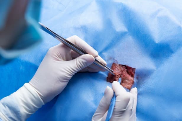 Treating Heart Attacks: The 2025 Step-by-Step Protocol