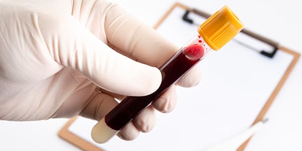 std-Testing