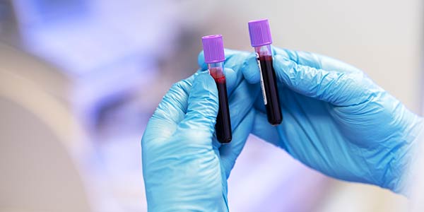 Cutting-Edge Anemia Testing