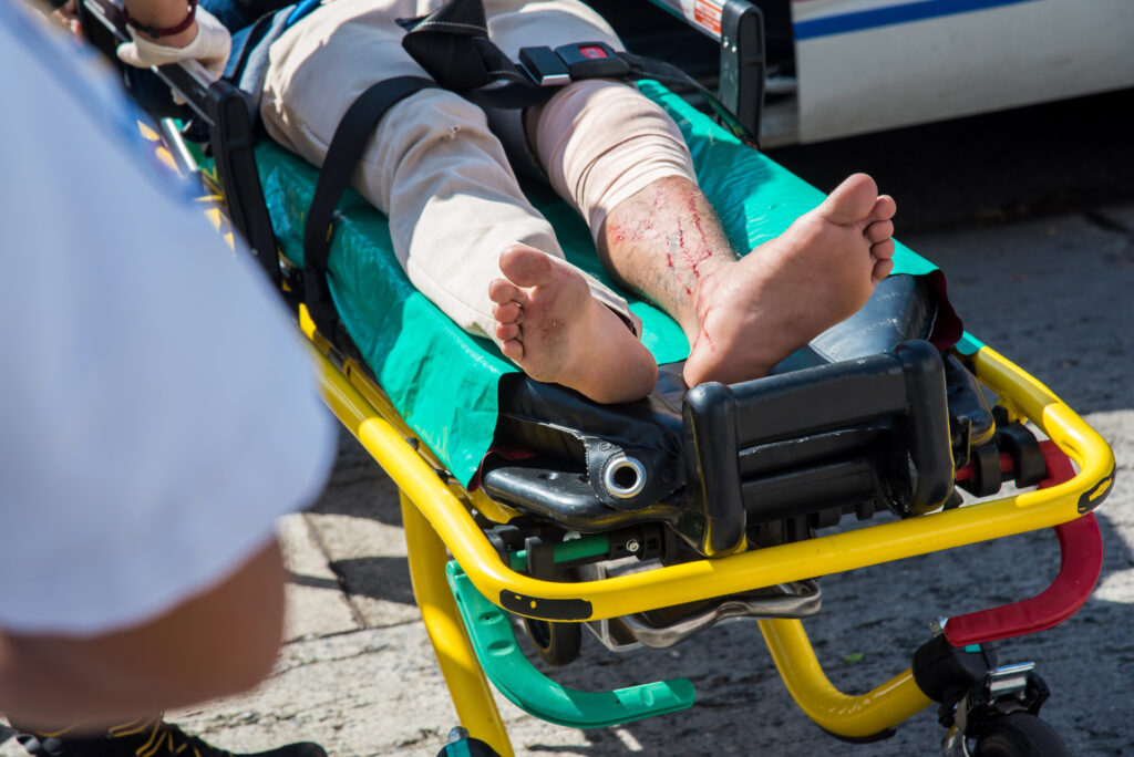 Car accident causing acute complicated injury